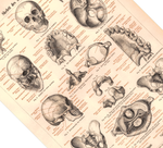 Das Poster eines menschlichen Skeletts ist eine Vintage Lithographie aus Meyers Koversations-Lexikon aus dem Jahr 1890.